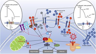 Sodium-Glucose Cotransporter 2 Inhibitors Potentially Prevent Atrial Fibrillation by Ameliorating Ion Handling and Mitochondrial Dysfunction